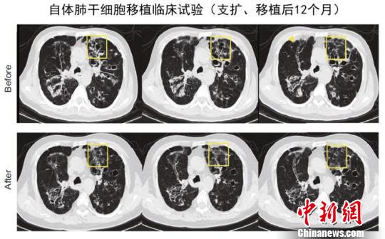 點擊進入下一頁