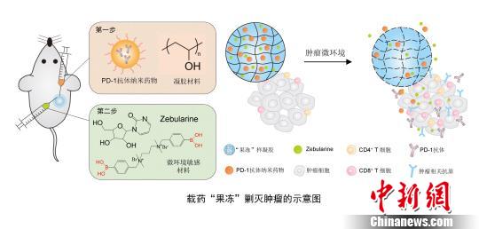 中美學(xué)者聯(lián)合研發(fā)出新型抗癌制劑載藥“果凍”剿滅腫瘤